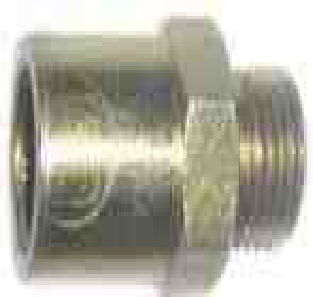 massey-ferguson-over-flow-valve