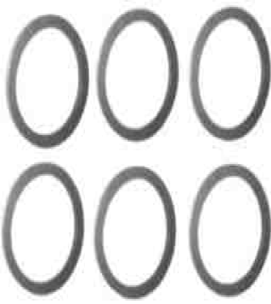 massey-ferguson-carrier-unit-pin-washer-set